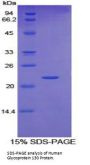 Human Glycoprotein 130 (gp130) Protein