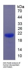 Human Glycoprotein 130 (gp130) Protein