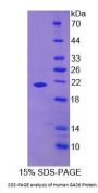 Human Growth Arrest Specific Protein 6 (GAS6) Protein