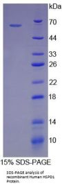Human Heat Shock 60 kDa Protein 1, Chaperonin / HSP60 (HSPD1) Protein