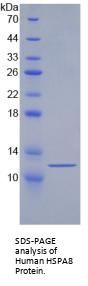 Human Heat Shock 70 kDa Protein 8 (HSPA8) Protein