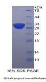 Human Heat Shock 70 kDa Protein 9 (HSPA9) Protein