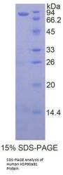 Human Heat Shock Protein 90 kDa Alpha B1 (HSP90aB1) Protein