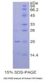 Human Hedgehog Homolog, Indian (IHH) Protein