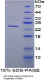 Pig Heme Oxygenase 1, Decycling (HO1) Protein