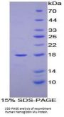 Human Hemoglobin Mu (HBm) Protein