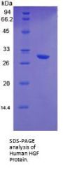 Human Hepatocyte Growth Factor (HGF) Protein
