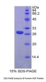 Human Hepatocyte Growth Factor (HGF) Protein
