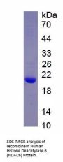 Human Histone Deacetylase 6 (HDAC6) Protein
