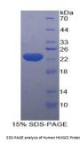 Human Hydroxymethylglutaryl-CoA Synthase, Cytoplasmic (HMGCS1) Protein