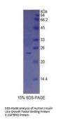 Human Insulin Like Growth Factor Binding Protein 6 (IGFBP6) Protein