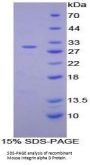 Mouse Integrin Alpha D / CD11D (ITGAD) Protein