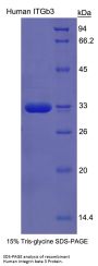 Human Integrin Beta III / CD61 (ITGB3) Protein