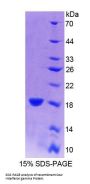Cow Interferon Gamma (IFNg) Protein