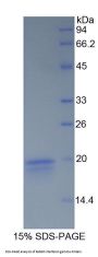 Rabbit Interferon Gamma (IFNg) Protein