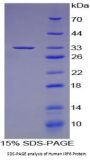 Human Interferon Regulatory Factor 6 (IRF6) Protein