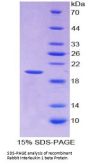 Rabbit Interleukin 1 Beta (IL1b) Protein