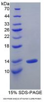 Human Interleukin 10 Receptor Alpha (IL10Ra) Protein