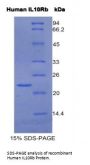 Human Interleukin 10 Receptor Beta (IL10Rb) Protein