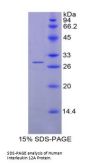 Human Interleukin 12A (IL12A) Protein