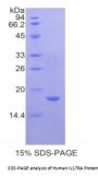 Human Interleukin 17 Receptor A (IL17RA) Protein