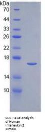 Human Interleukin 2 (IL2) Protein