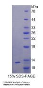 Human Interleukin 6 Receptor (IL6R) Protein