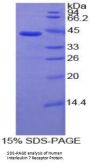 Human Interleukin 7 Receptor (IL7R) Protein