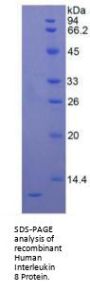 Human Interleukin 8 (IL8) Protein