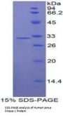Human Tyrosine-protein kinase JAK1 (JAK1) Protein