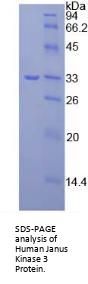 Human Tyrosine-Protein Kinase JAK3 (JAK3) Protein