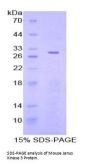 Mouse Tyrosine-Protein Kinase JAK3 (JAK3) Protein