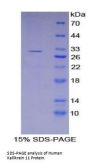 Human Kallikrein 11 (KLK11) Protein