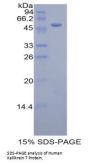 Human Kallikrein 7 (KLK7) Protein