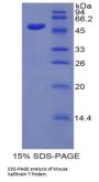Mouse Kallikrein 7 (KLK7) Protein