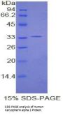 Human Karyopherin Alpha 1 (KPNa1) Protein