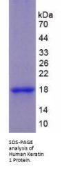 Human Keratin 1 (KRT1) Protein