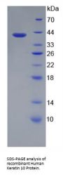 Human Keratin 10 (KRT10) Protein