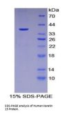 Human Keratin 15 (KRT15) Protein