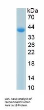 Human Keratin 16 (KRT16) Protein