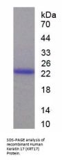 Human Keratin 17 (KRT17) Protein