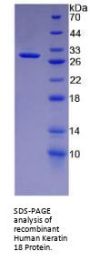 Human Keratin 18 (KRT18) Protein