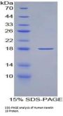 Human Keratin 19 (KRT19) Protein