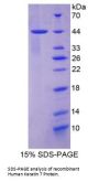 Human Keratin 7 (KRT7) Protein