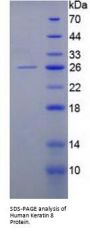 Human Keratin 8 (KRT8) Protein