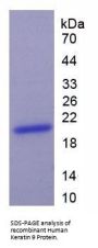 Human Keratin 9 (KRT9) Protein