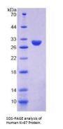Human Proliferation Marker Protein Ki-67 (MKI67) Protein