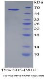 Human Killer Cell Immunoglobulin Like Receptor 2DL3 (KIR2DL3) Protein