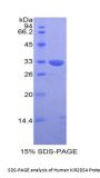 Human Killer Cell Immunoglobulin Like Receptor 2DS4 (KIR2DS4) Protein