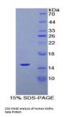 Human Klotho Beta (KLb) Protein